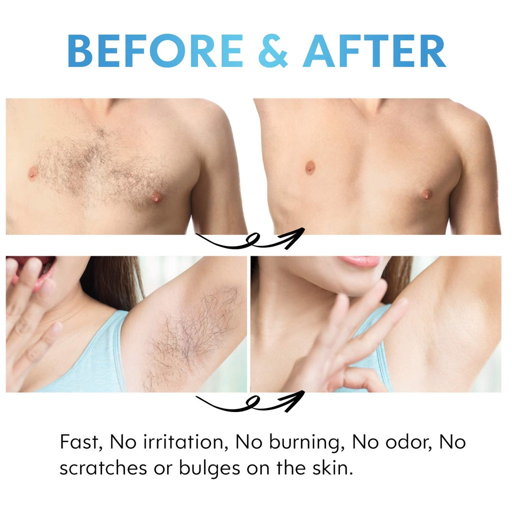 Bleame Crystal Hair Eraser – Painless Exfoliation Hair Removal Tool For Arms Legs Back China (Random Color)